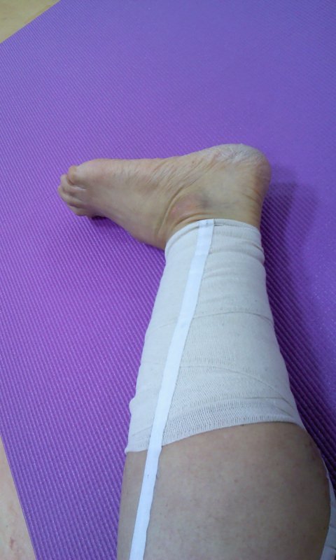 천일 기도중 847일째(동파의 오른쪽 다리 완치된 날)