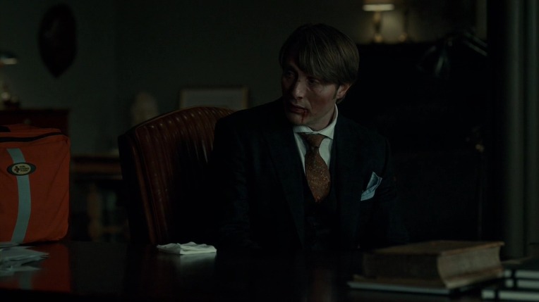 본격침샘어택미드 한니발(Hannibal) 시즌1 에피8 Formage (4/4) | 인스티즈